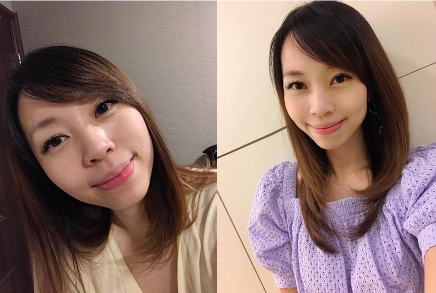 【皮秒雷射(廣特探索皮克雷射系統)】