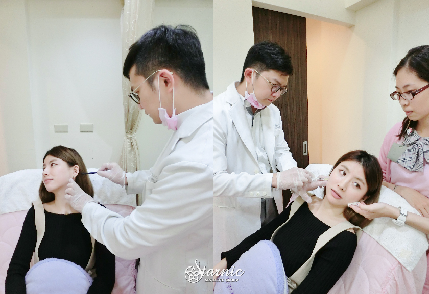 【天使瘦小臉注射】星和診所（新竹市）-薛傅今院長-給我臉部線條美炸天-藍忻雅 (上)