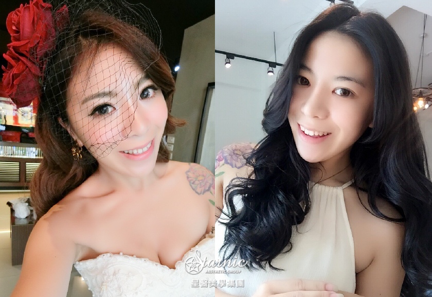 【雙眼皮+眼皮取脂+開眼頭】星和診所/高雄醫美_夢寐以求的完美雙眼皮GET!!!_陳蕎蕎