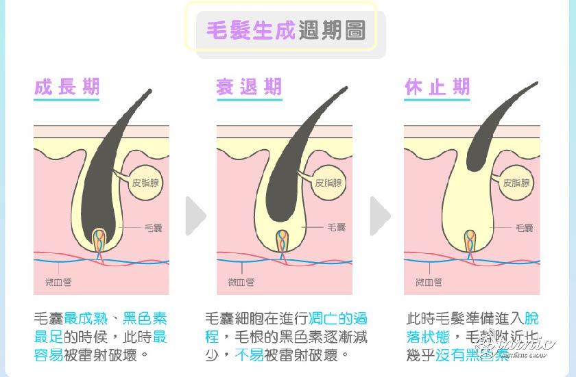 【雷射除毛】