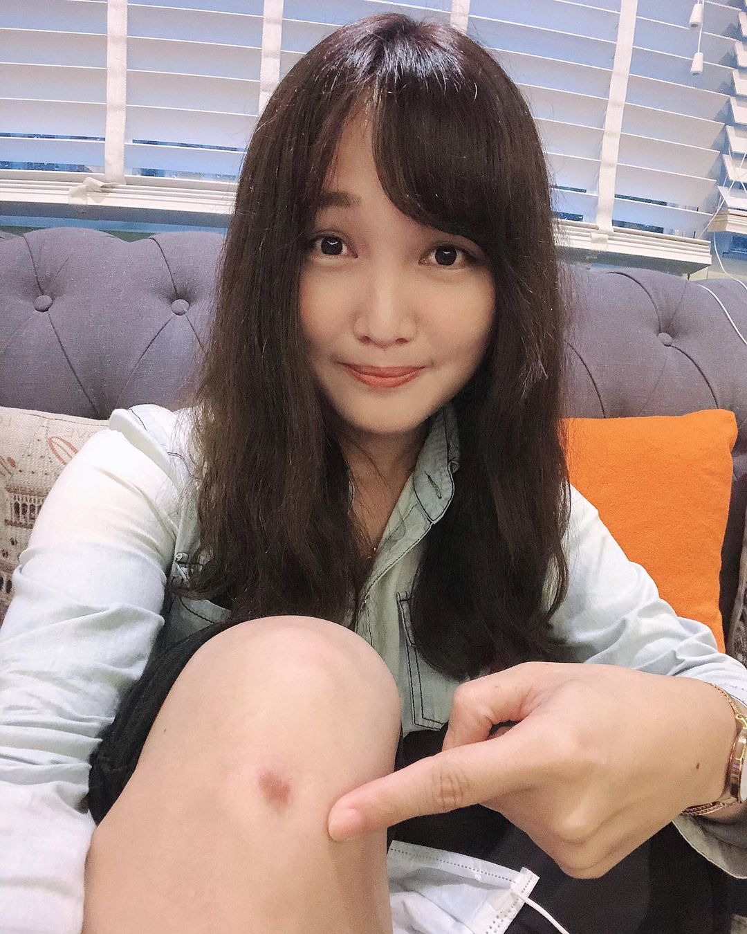 【皮秒雷射】星采整形外科診所(大安)-搭配櫻花染料除疤比較快_♡♡ᴍɪᴋᴜ♡♡ғᴜɴ閃情旅