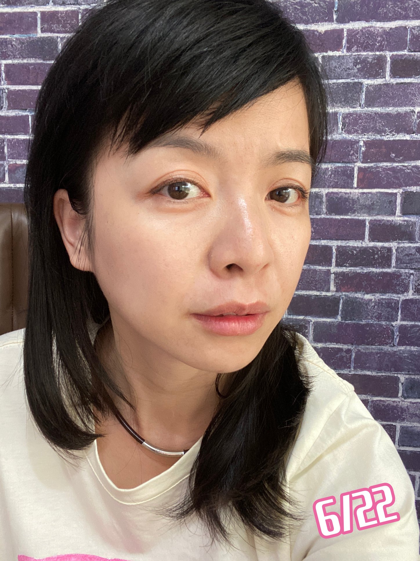 【皮秒雷射】星和診所-台中市-素顏也能感受到白、透、亮，恢復速度有如超跑‼️_環遊世界的小羊兒