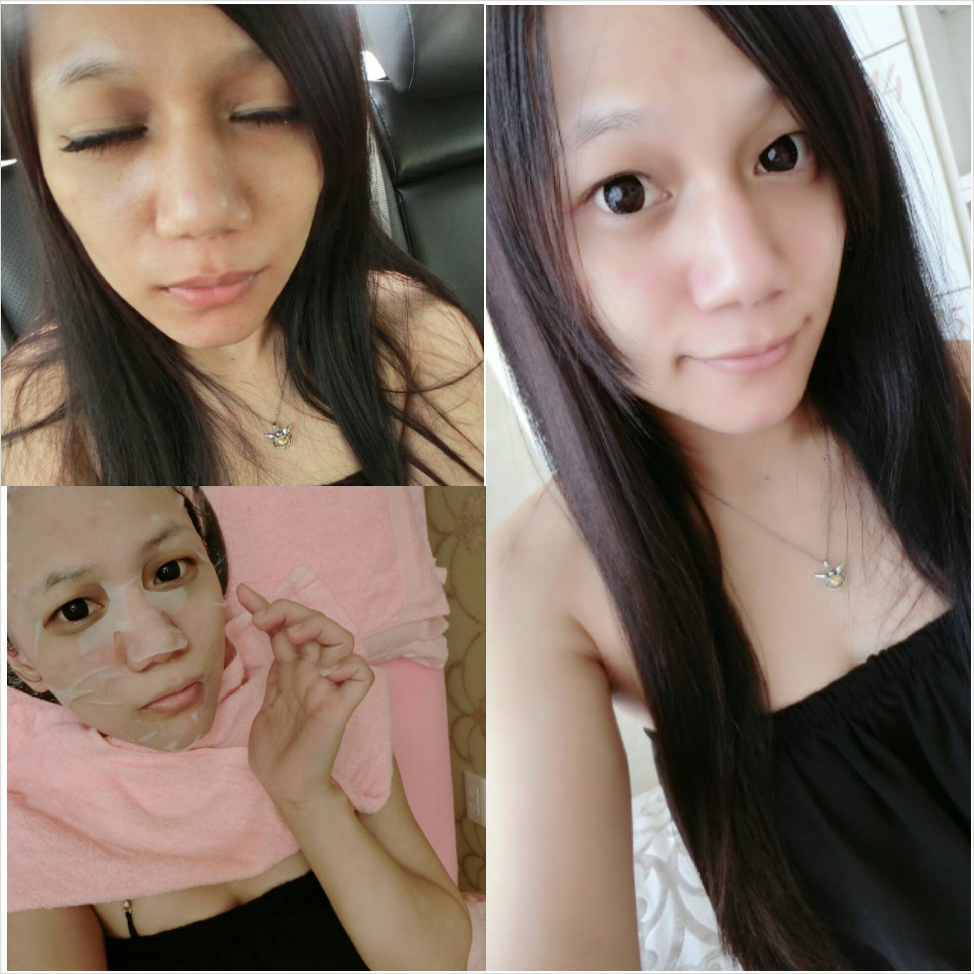 【杏仁酸煥膚】星和診所-桃園市-做完杏仁酸整皮膚整個都亮了起來_李菲菲