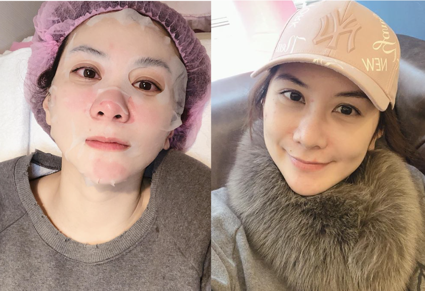 【杏仁酸煥膚】仁愛星和診所/東區醫美-體驗清爽亮白！投資自己永遠不嫌晚- Emily X Amèlie、湯若以(下)