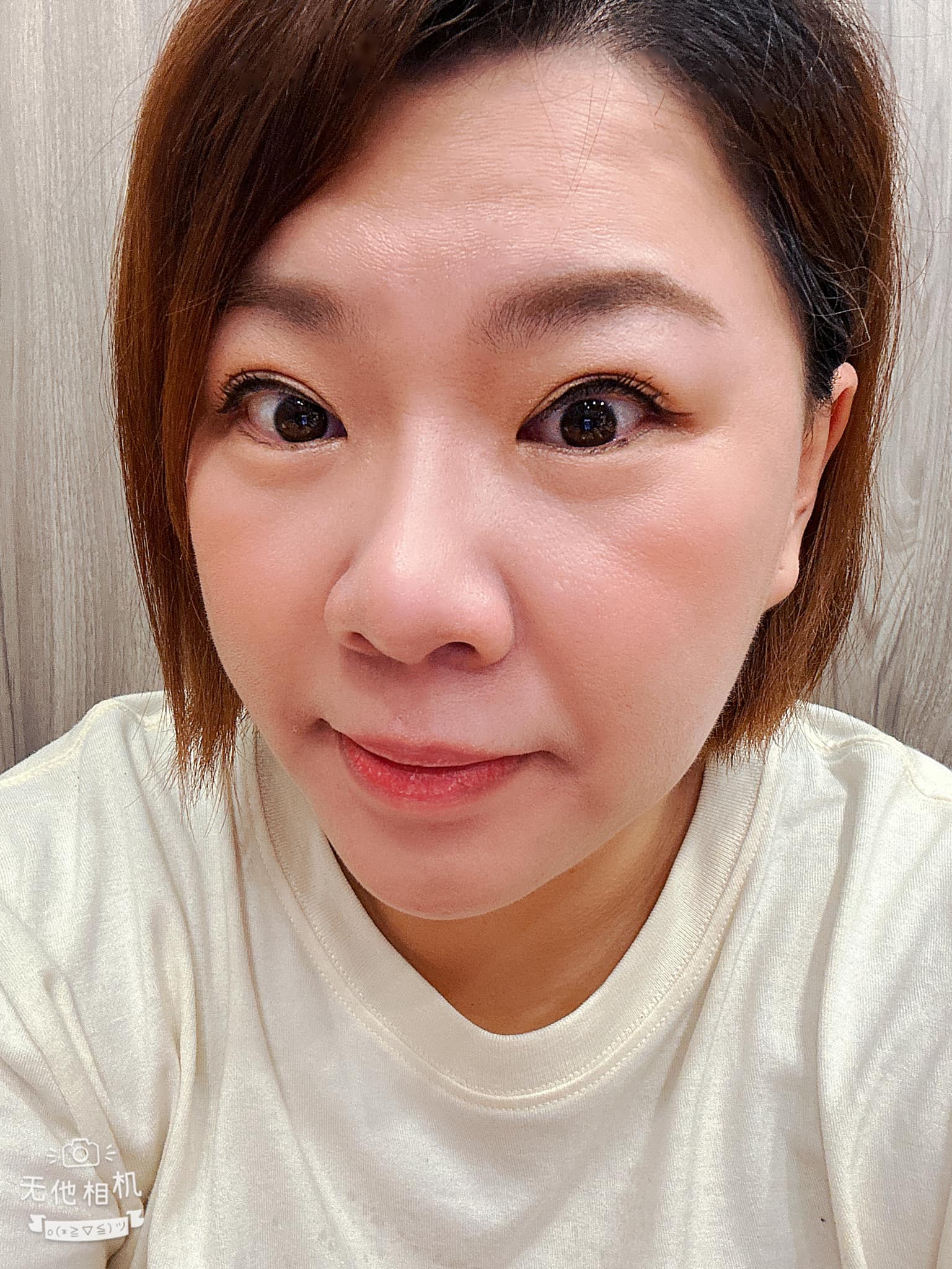 【皮秒雷射】