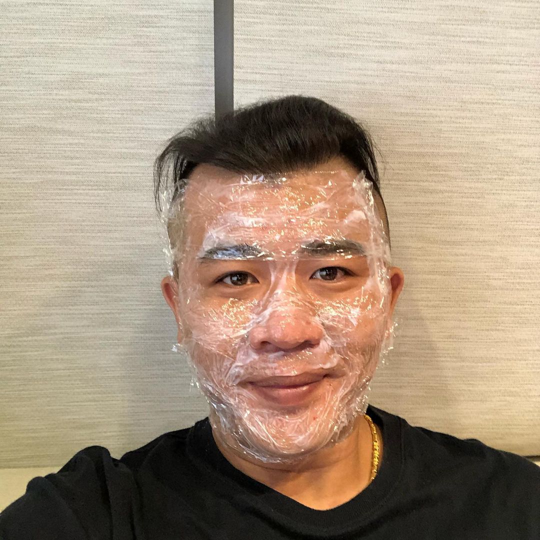 【皮秒雷射】星和診所-台中市-不只氣色變好，臉部的坑疤有明顯改善-超艾這一家