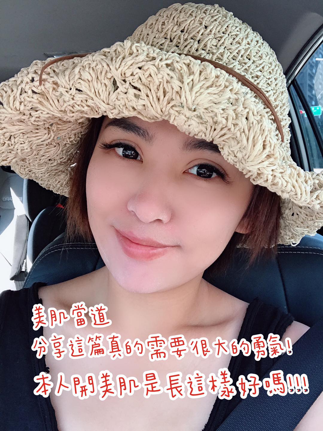 【皮秒雷射】仁愛星和診所 武洵白醫師-長年痘痘暗沈肌都有救了妳們一定也可以！_豬肉小姐的育兒樂園