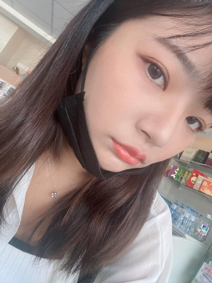   【杏仁酸】星和診所/台南醫美♥做完過幾天皮膚都ㄉㄨㄞㄉㄨㄞ的 -炎炎