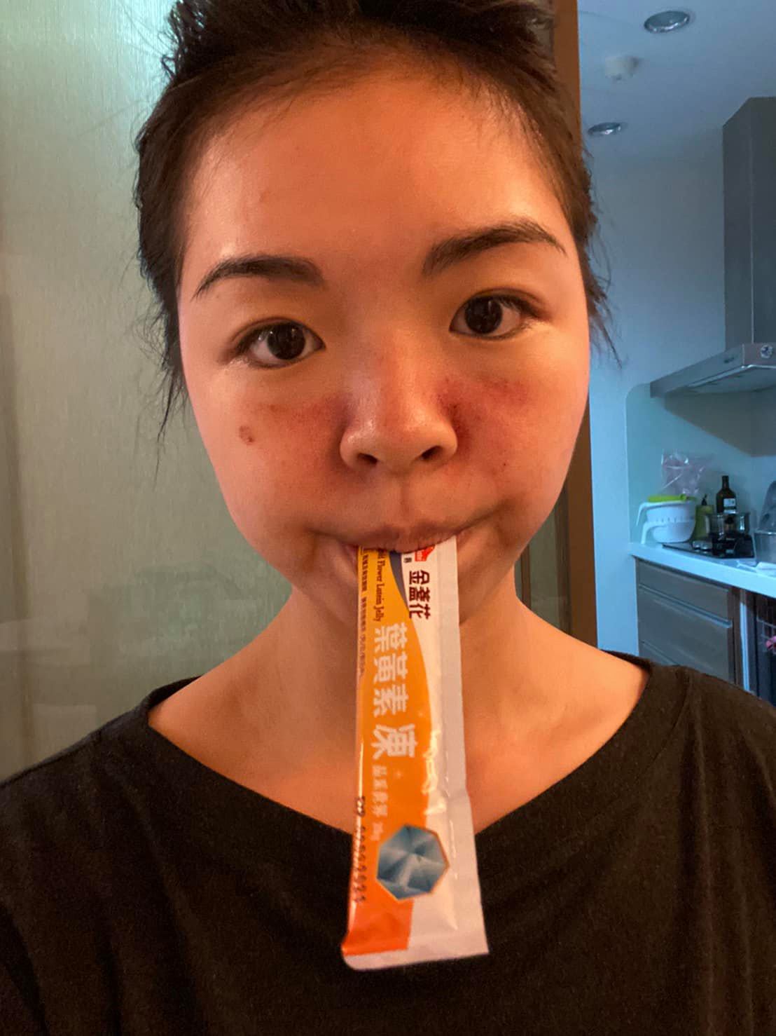 【皮秒雷射】星和診所-台南市-美無法，定量但舒服是美的第一要素_1男+4胞胎=五寶媽