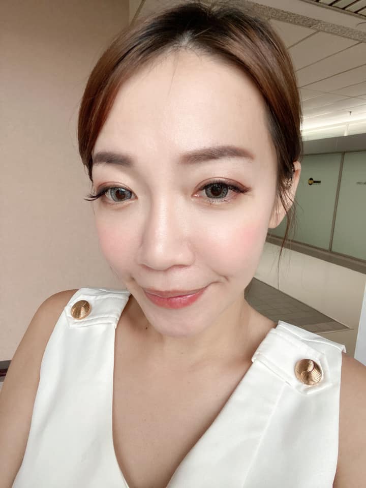 【皮秒雷射】台北星和診所-看到毛孔變小、皮膚變好變透感覺真的很好❤️_施怡如