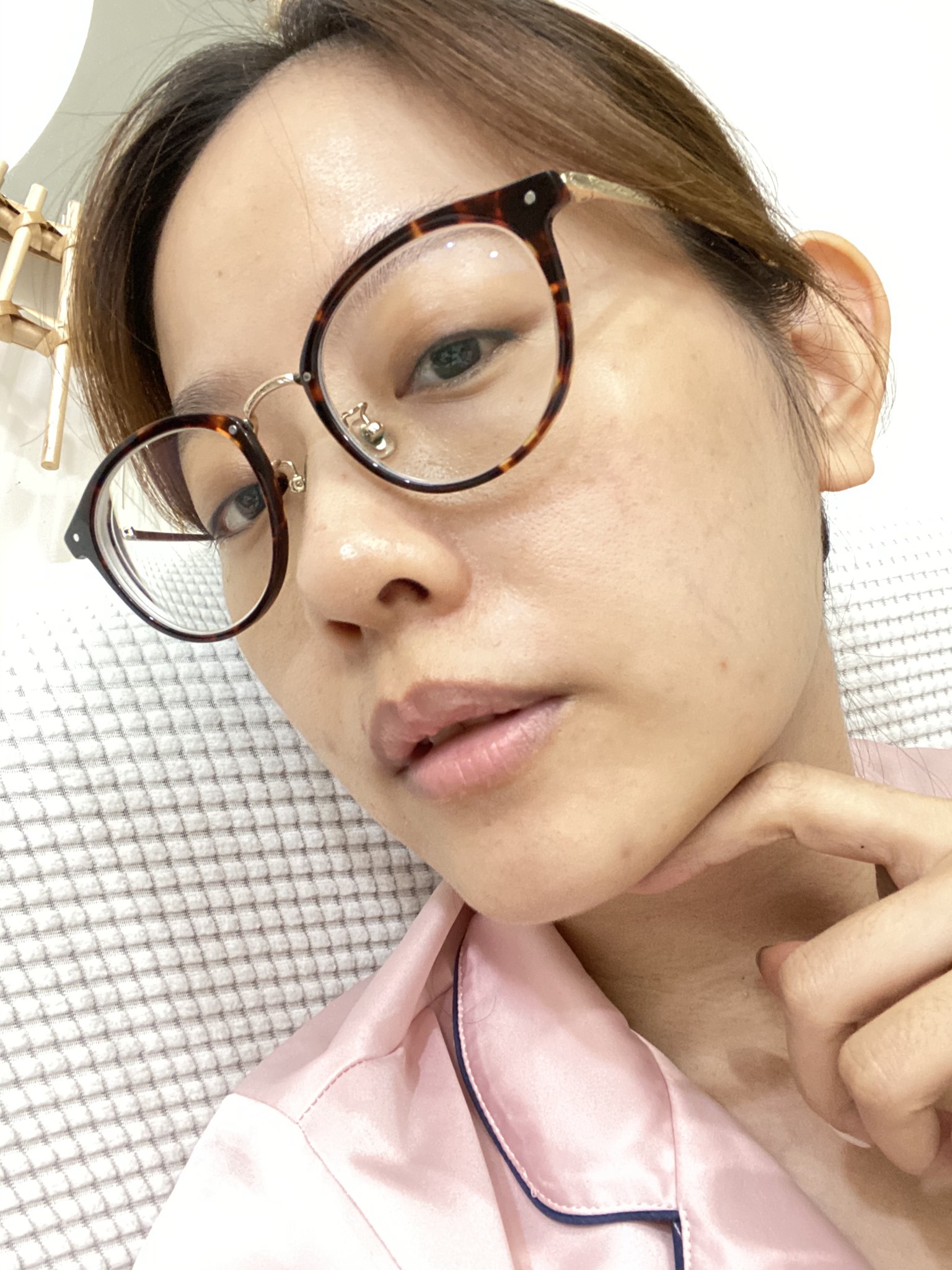【皮秒雷射】仁愛星和診所-讓肌膚看起來更亮更乾淨一點!_shelly.pan