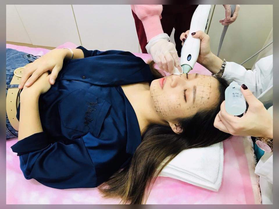 【電波拉皮】電波拉皮能讓皮膚變得更緊緻，還能增生新的膠原蛋白讓皮膚更好， 愛笑也不擔心有法令紋和babyface！！！～-紀晨心