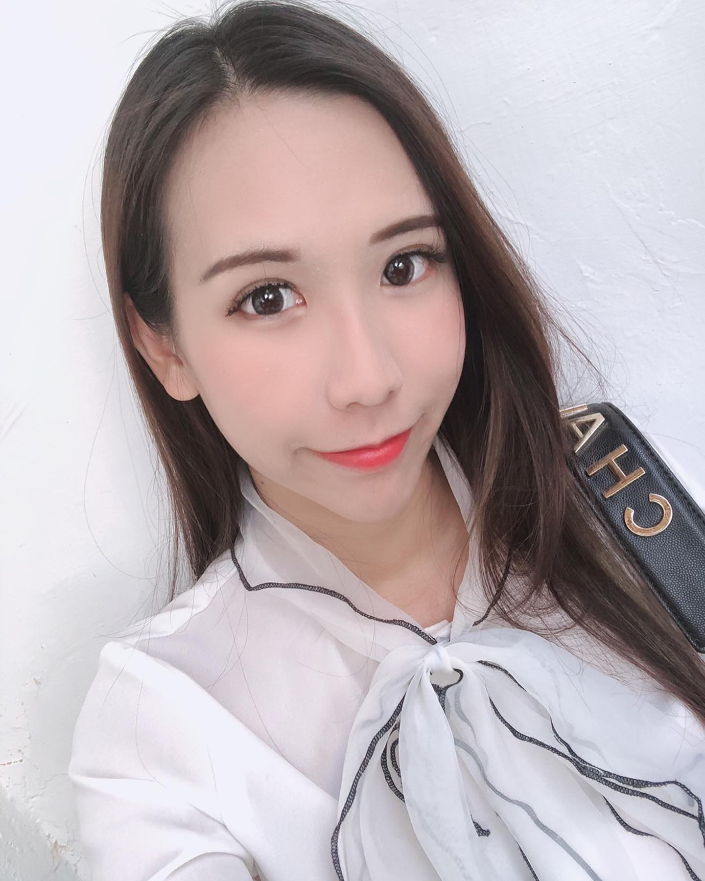    【活力滿點滴】星和診所/高雄醫美♥膚色明顯變白！！ -熊貓兒佳蓉