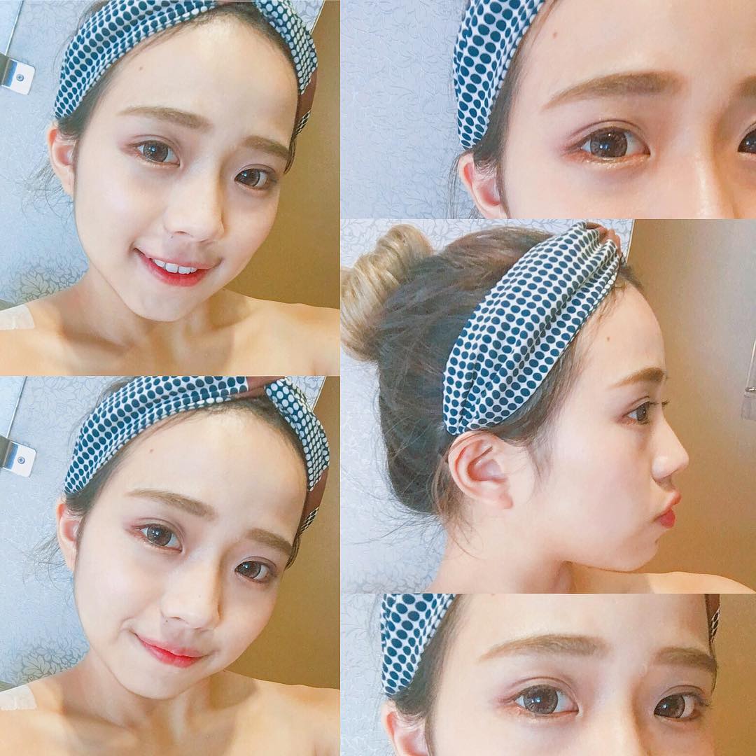 【活力滿點滴】星和診所/台中醫美-草莓小朋友