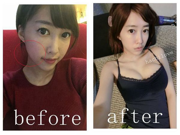 桃園醫美星和診所