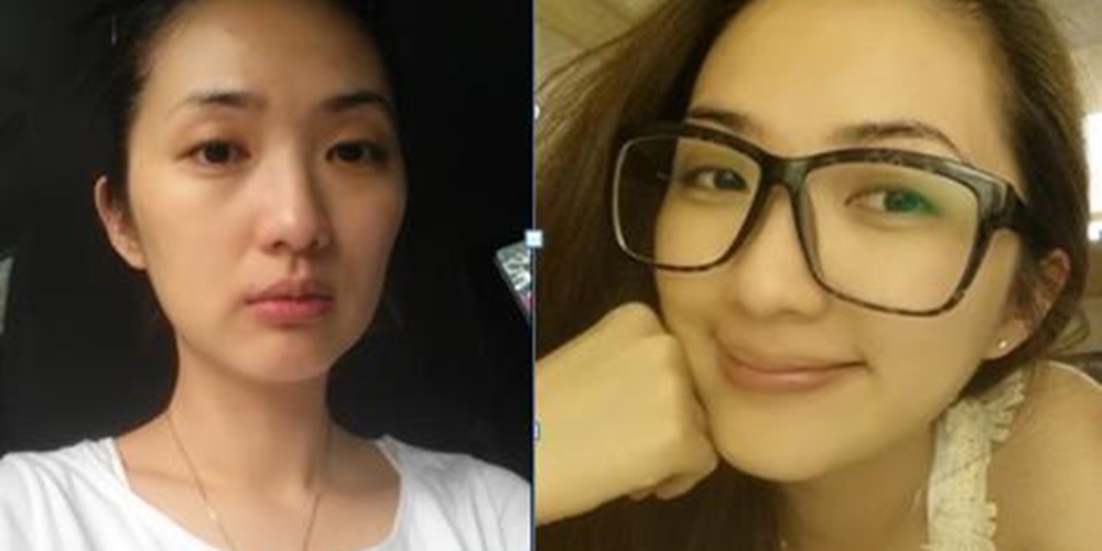 姊的春顏快回來～極線音波拉提來拯救姊姊囉！