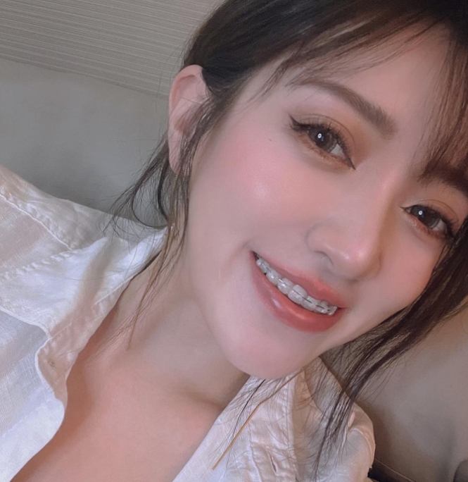 【玻尿酸】星和診所（新竹市）女為悅己者容 我只為自己而容-彩妝師雪倫 ??????