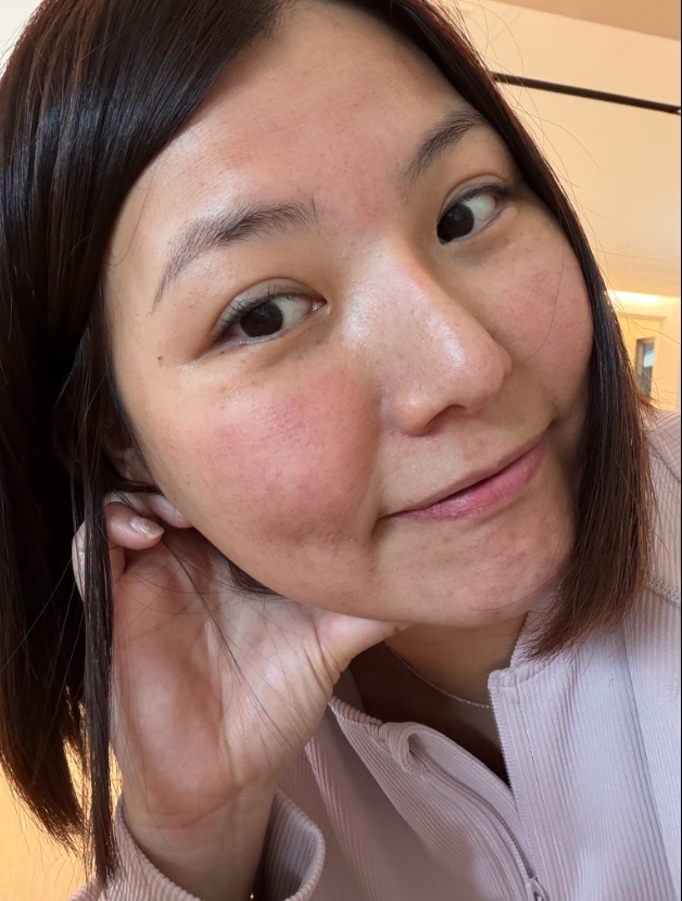 【夏娃電波】林口星和診所-先說結論，我自己覺得滿值得的。做完之後，意外覺得蠻有感-大V生活