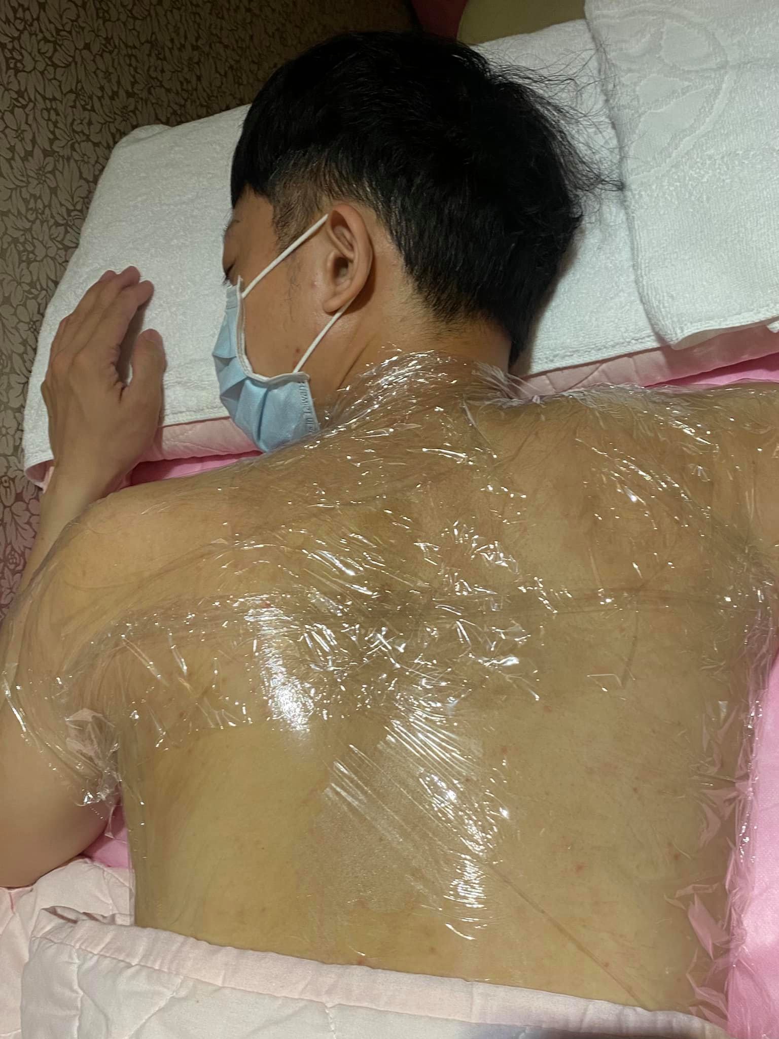 【杏仁酸】星和診所/高雄醫美-因為背痘一直以來困擾著我-張偉威