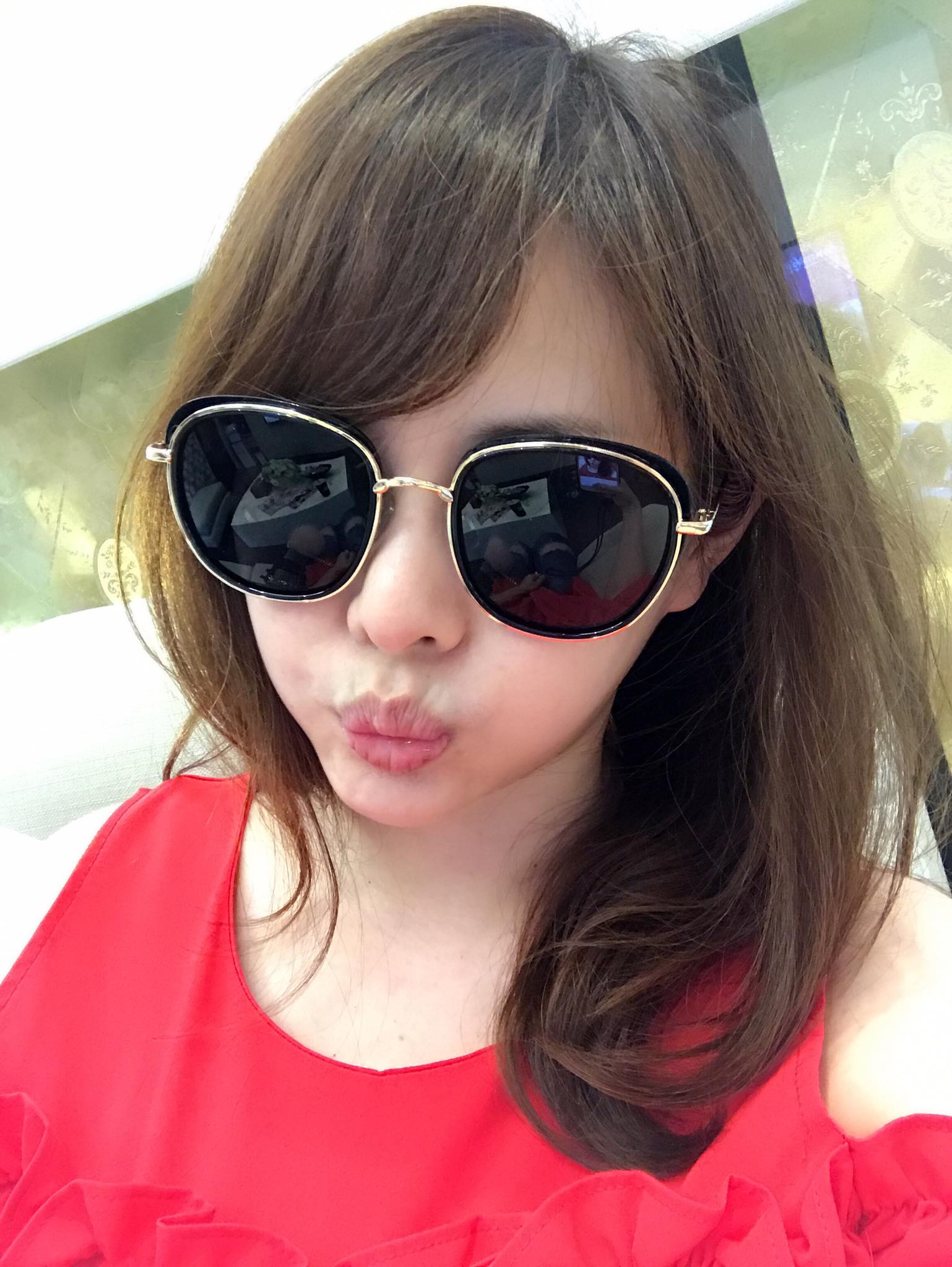【淨膚雷射】星和診所/台中醫美-擺脫黃臉婆的稱號-Vivian Hsu