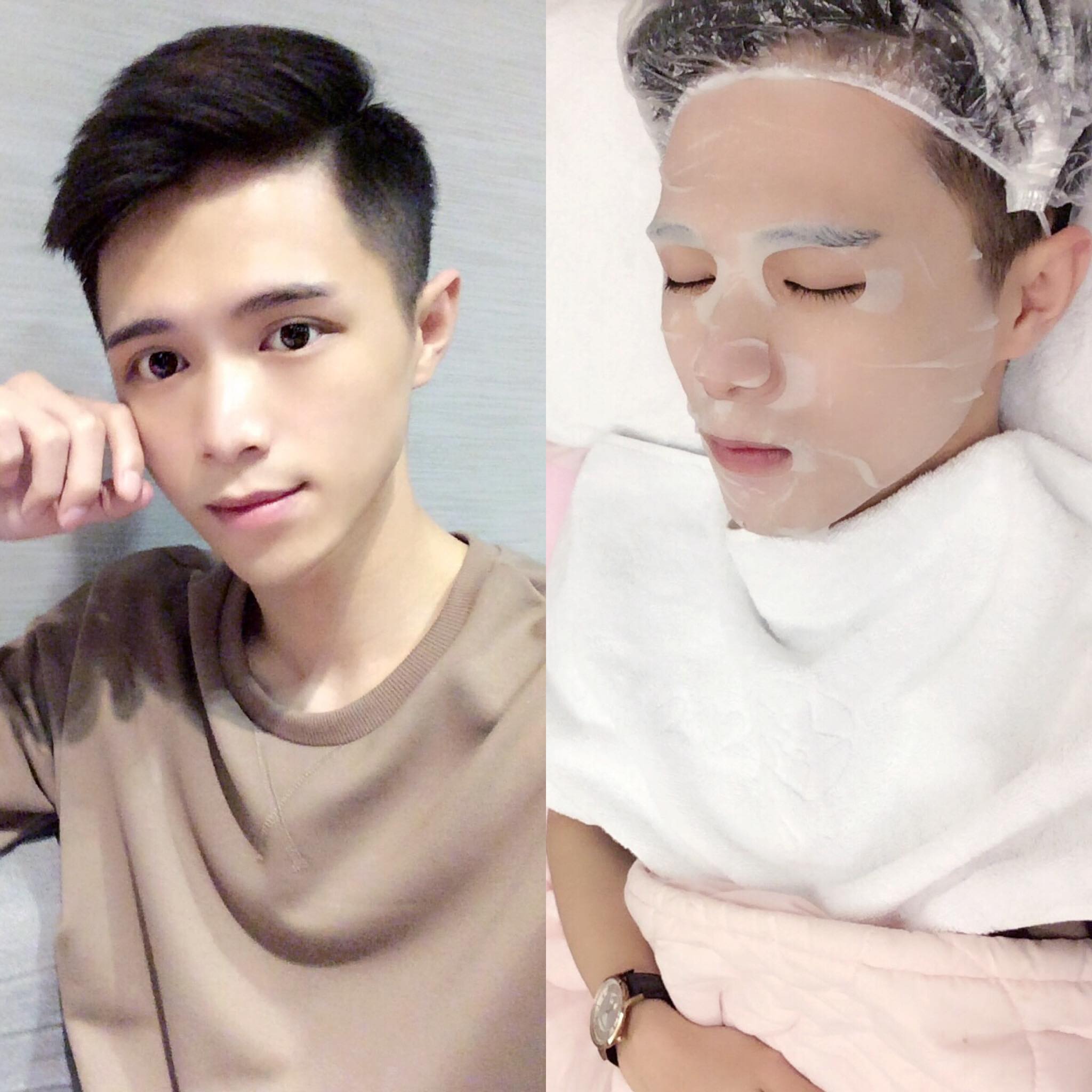 【杏仁酸】星和診所/台中醫美-最煩惱的膚質狀況做杏仁酸都有功效唷-李兒