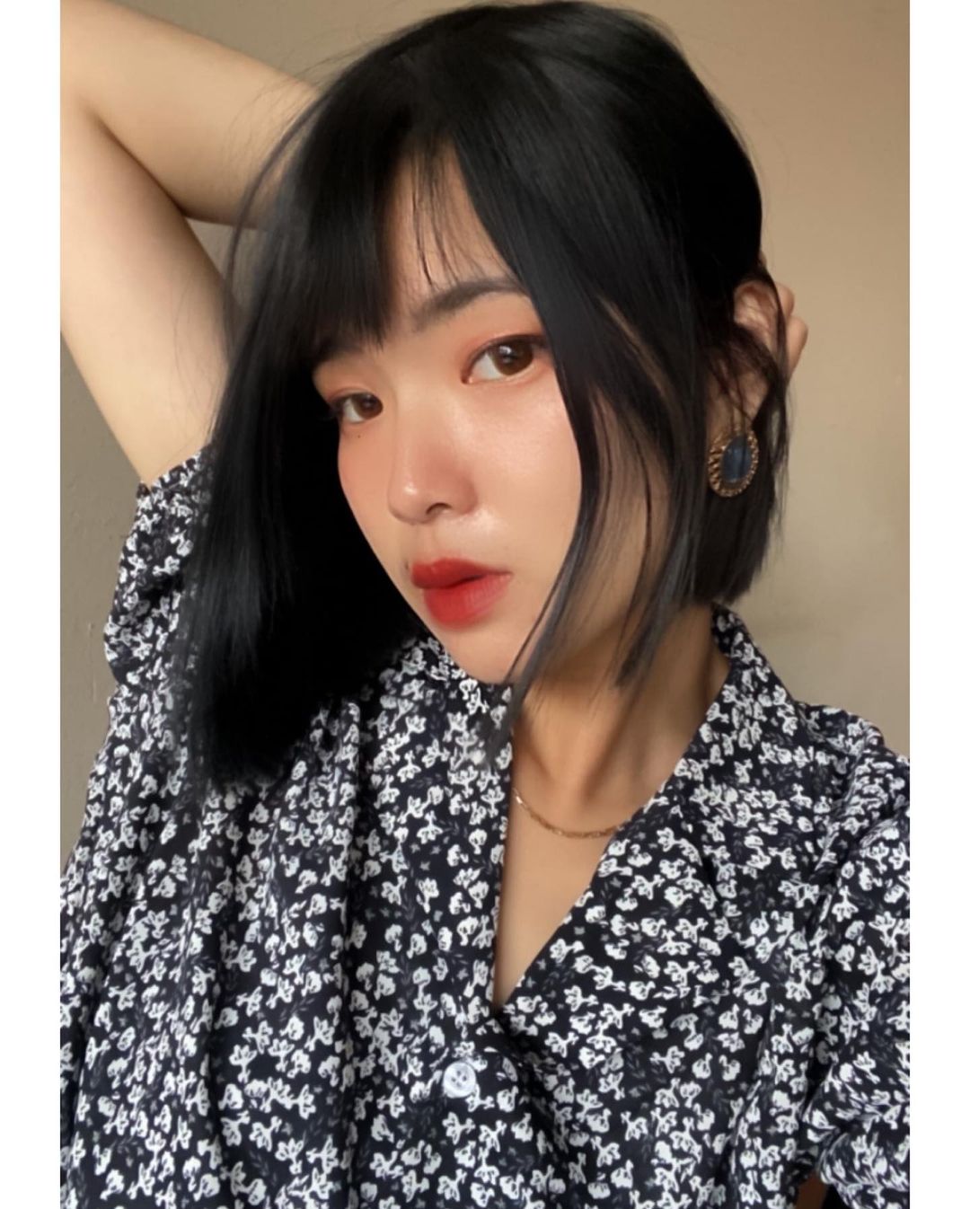 【杏仁酸】星和診所/台南醫美 -痘疤跟暗沉改善了很多-Jeanie J