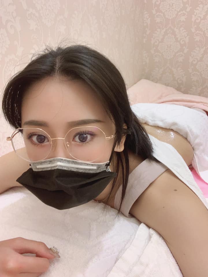 【杏仁酸】星和診所/桃園醫美-第一次效果就還挺好的淡了蠻多的，下個月我還要去做背部換膚-馮馮