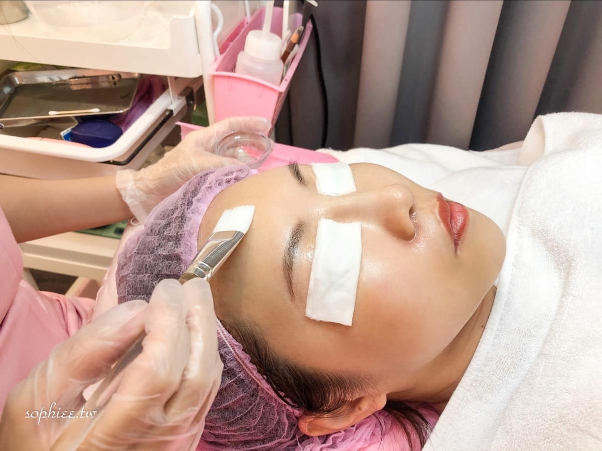 【杏仁酸】星和診所/台中醫美 -在保養療程之前先做杏仁酸保養的效果就會更加乘-蘇菲漫旅