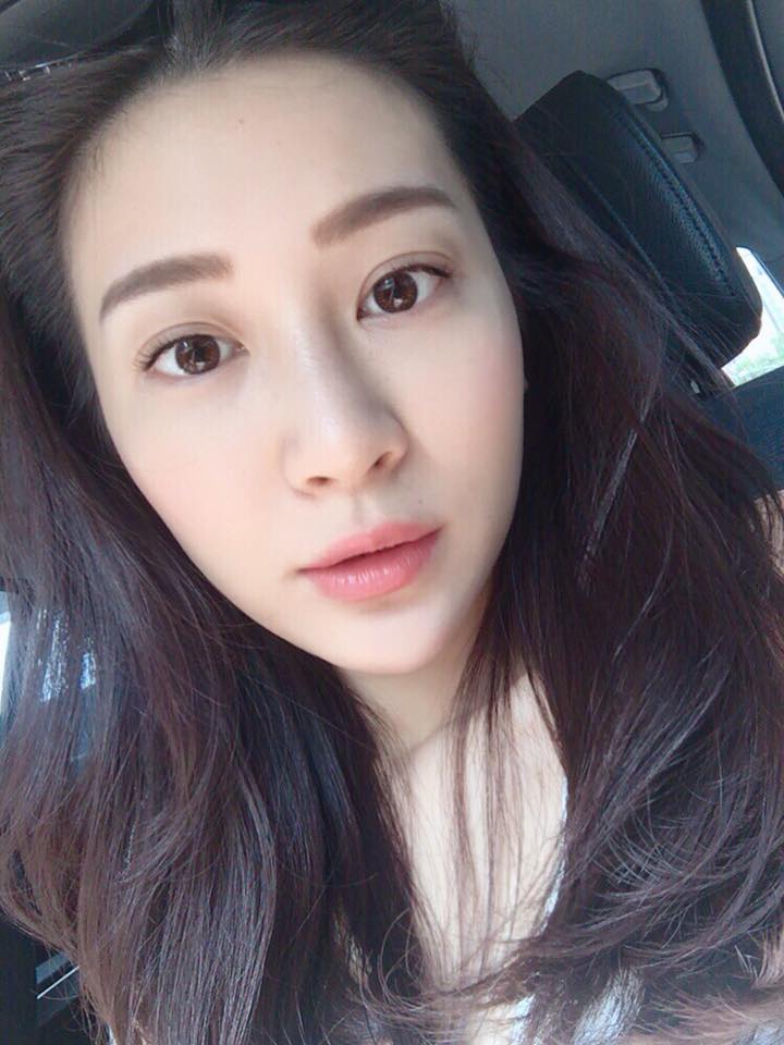 【維納斯脈衝光】星和診所/台中醫美-現在的紫外線真的太可怕了!-Teresa Lin