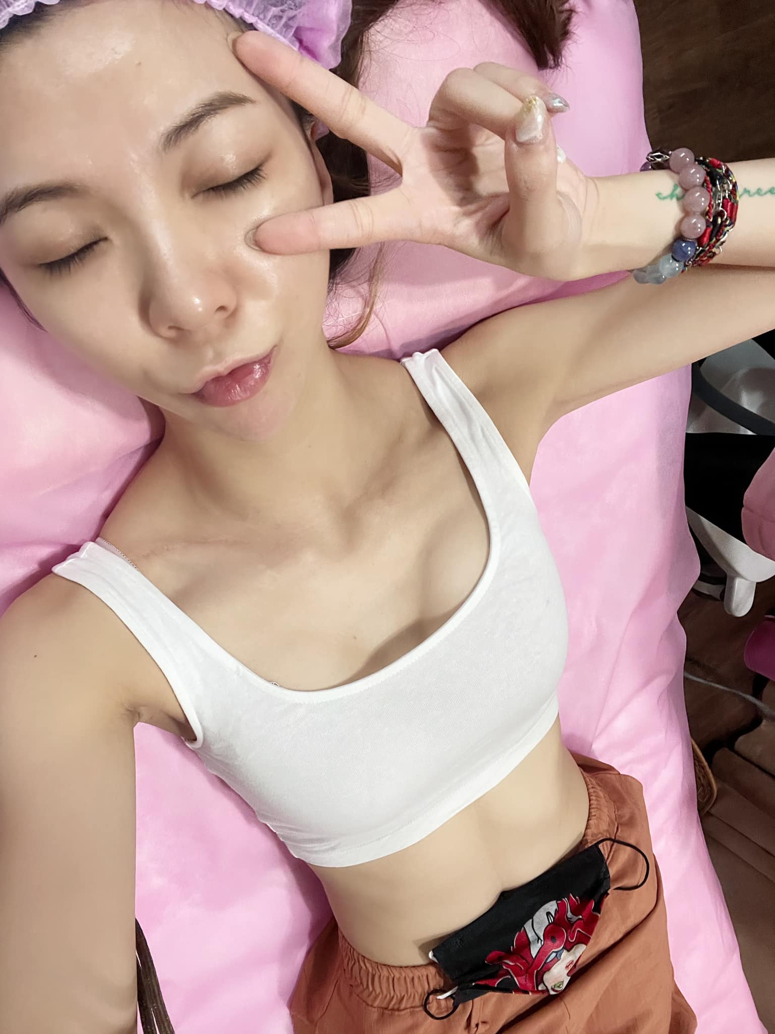 【彩衝光】星和診所/台中醫美_打完立即可以上班 但是這兩天要注意一下保濕唷 因敏感泛紅問題解決 臉色蠟黃不均解決_陳綠-Green Chen