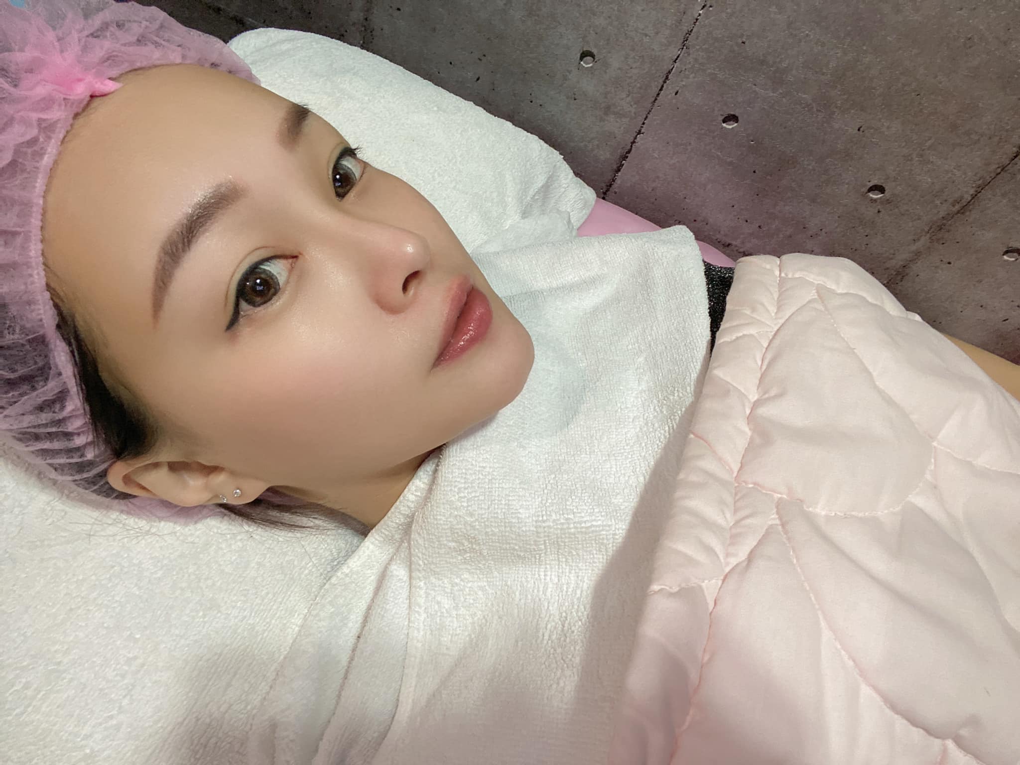 【杏仁酸】自強星和診所（竹北） -口罩戴好戴滿的日子 換來的就是粉刺痘痘長好長滿-彭妍妍(湘妍)