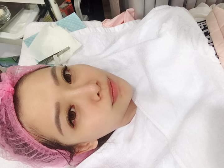【杏仁酸煥膚】杏仁酸深層淨化角質，提升真皮層保水度，溫和的無負擔保養，是創造好膚質的第一步❤❤！！！~-曾琬婷