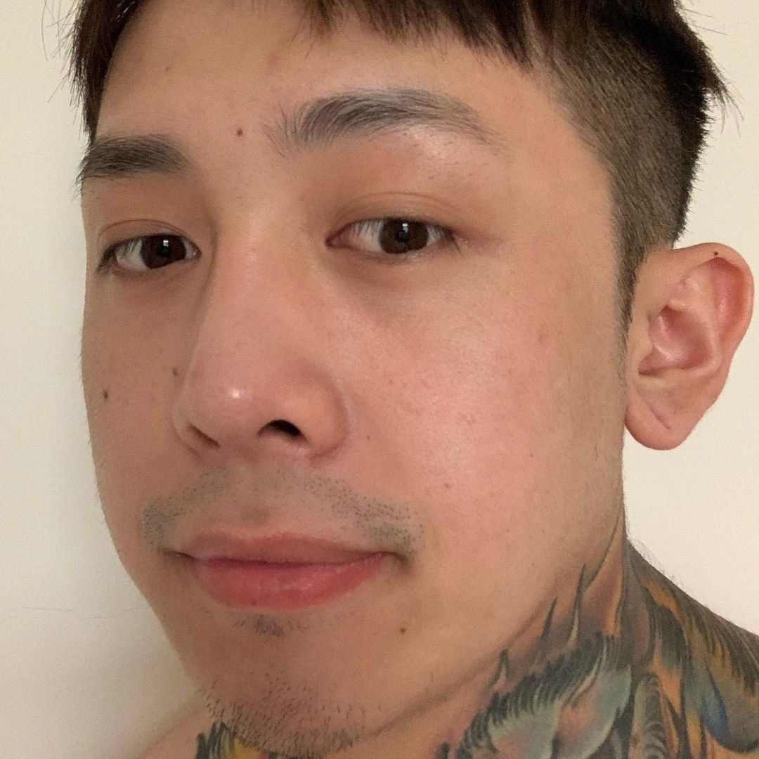【杏仁酸煥膚】星和診所/高雄醫美-膚摸起變得平滑有光澤?-王羿