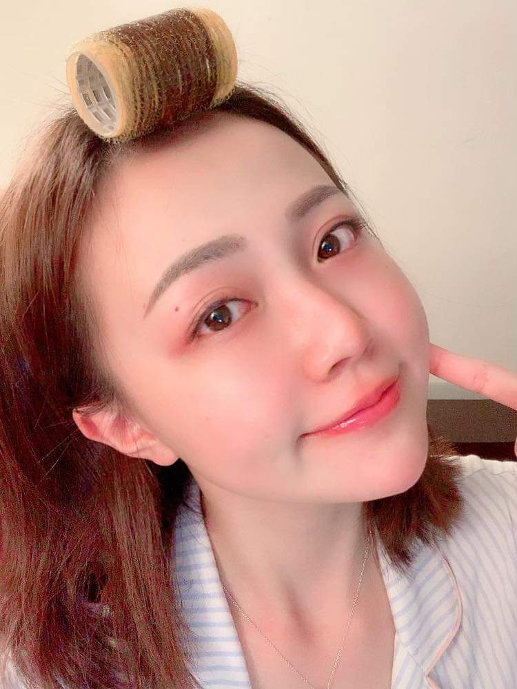 【淨膚雷射】星和診所/仁愛醫美-打完淨膚雷射好處多多，會讓皮膚代謝陳皮變白，還能把色素、痘疤、粉刺、痘痘殲滅！！～-思綺 Pocky