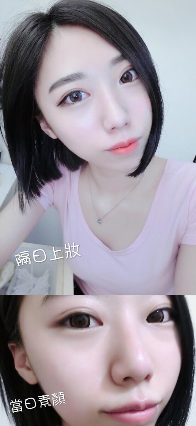 【杏仁酸】星和診所/台中醫美-好肌膚好心情-水水