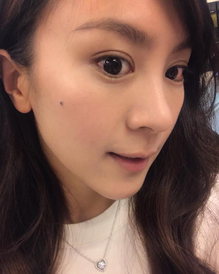 【維納斯脈衝光】星和診所/台中醫美-打完之後勤敷臉皮膚變得好亮喔！-張子庭 - 庭庭