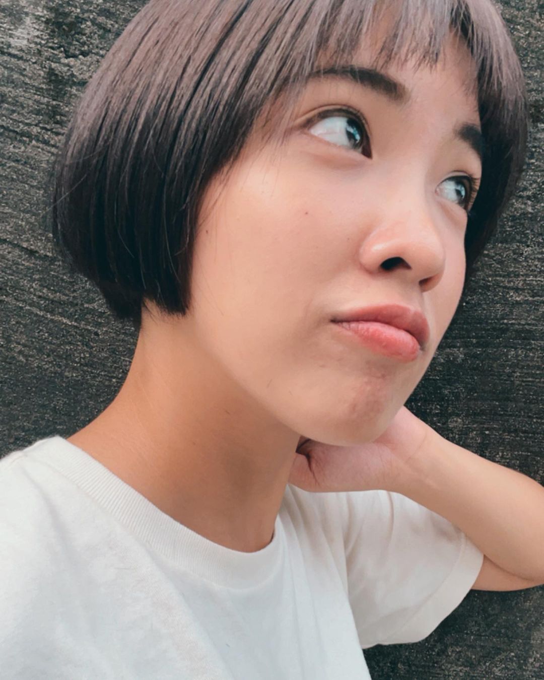 【杏仁酸煥膚】星和診所/北車醫美-等痘痘消掉之後，臉整個⋯亮⋯⋯✨-怡岑