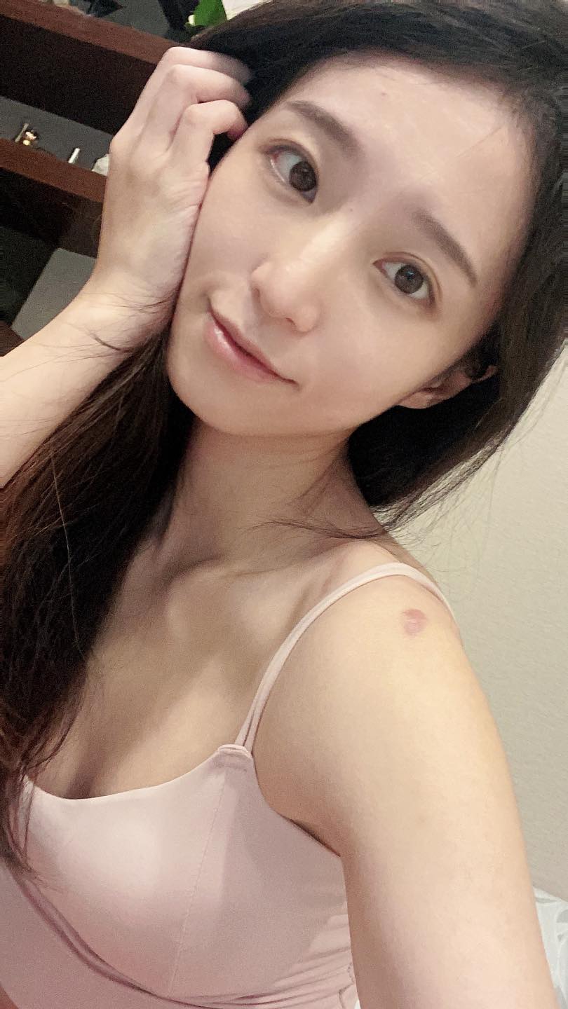 【彩衝光】星和診所/高雄'醫美-♥醫師還幫我加強兩頰，可能是覺得我需要縮小毛孔了吧_元氣女孩 小慈 粉絲加油團