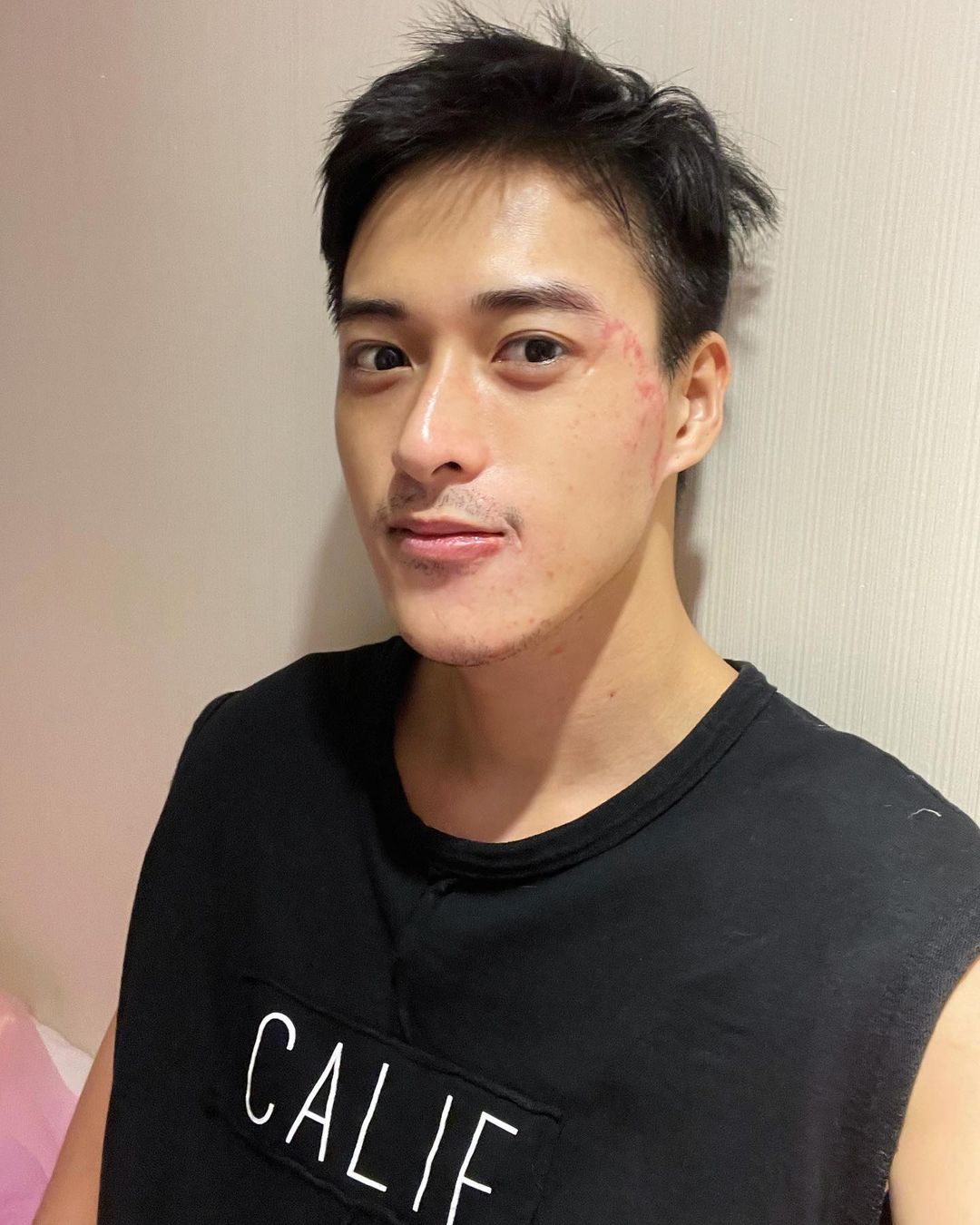 【杏仁酸煥膚】星和診所/仁愛店-做完杏仁酸我又滿血復活了-于秉鑫