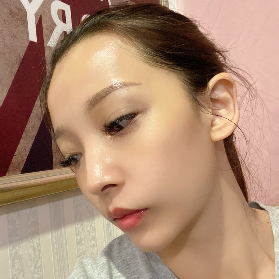 【杏仁酸煥膚】星和診所/仁愛店-做完保養 皮膚真的亮到不行，女人真的要好好保養自己-Pei。細粒雨