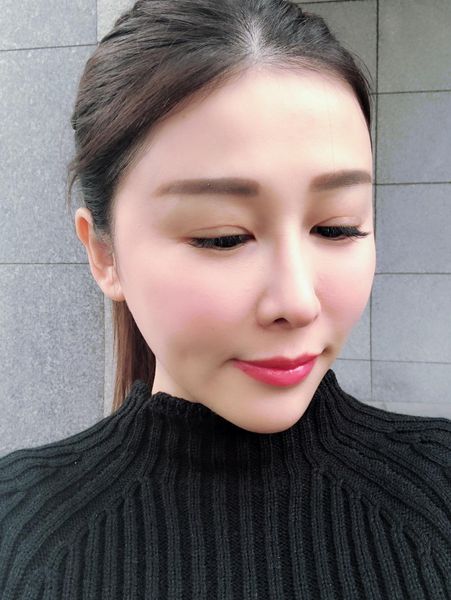 【皮秒雷射】過年可以美美見人啦