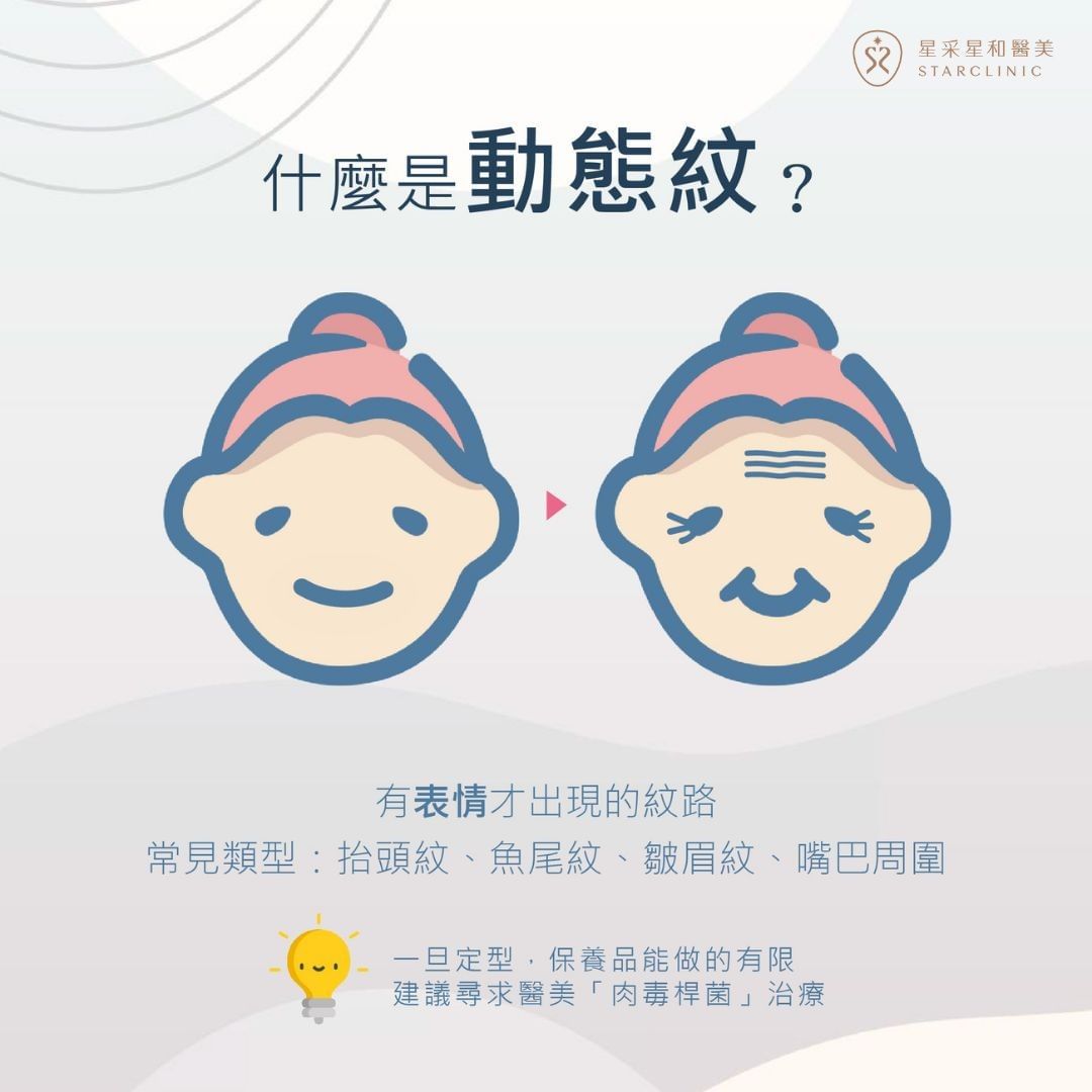 什麼是動態紋？