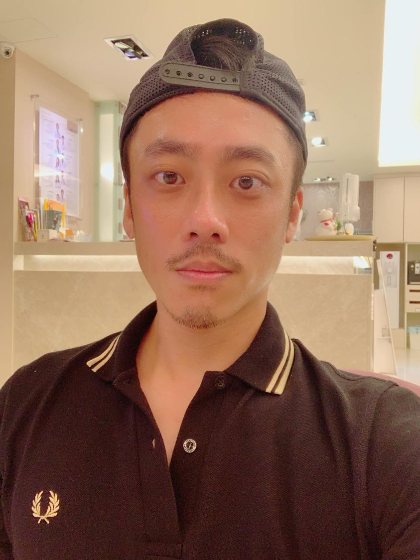 【杏仁酸煥膚】星和診所/大安店-鼻頭的粉刺超多的人，快來試試我喜愛的療程吧-劉沃夫
