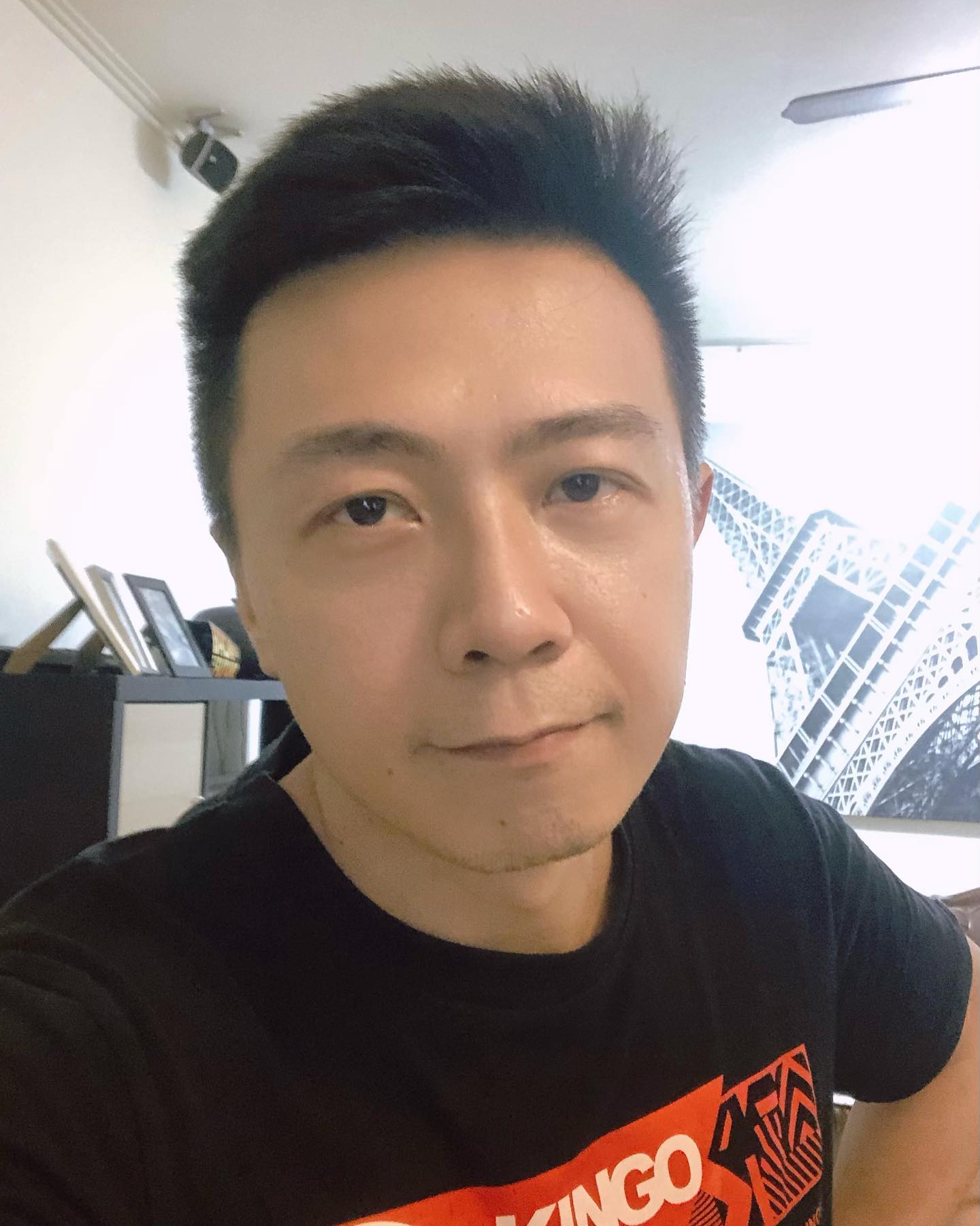 【皮秒雷射】星和診所/台中醫美-看看這術前術中術後差多少?-廖峻/ 錦德