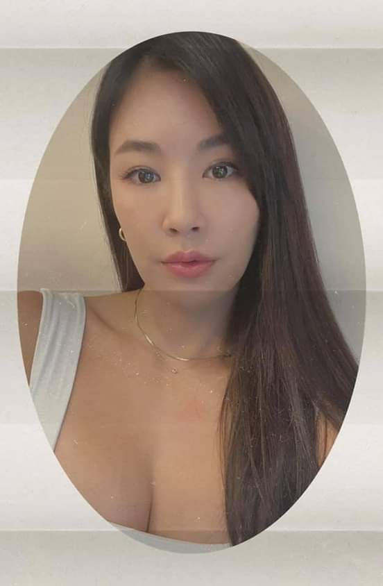 【肉毒桿菌】這次肉毒治療部分打了抬頭紋、皺眉紋還順便打了魚尾紋，希望整個額頭能夠有發亮的好氣色！！！～-咪咪愛運動 Mimi sparkle