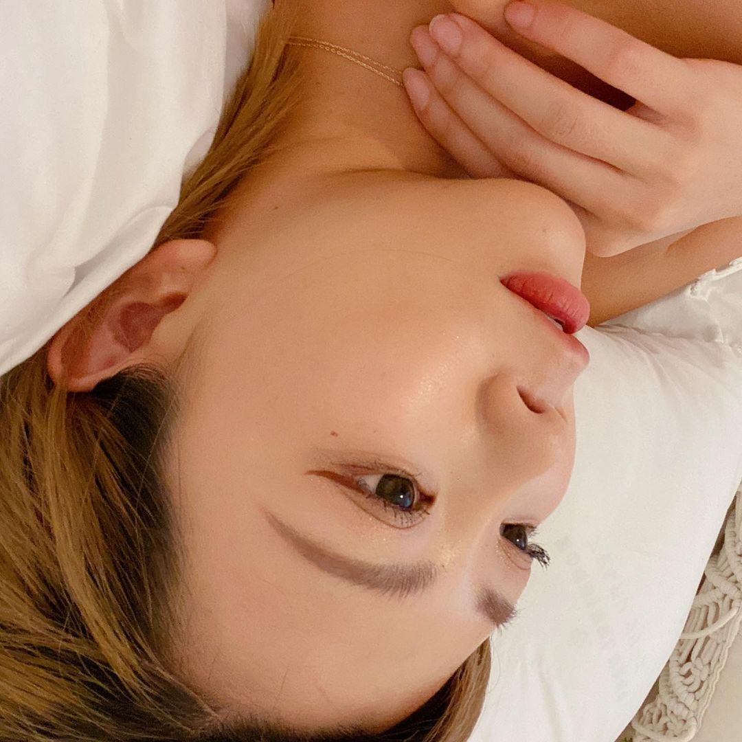 【杏仁酸煥膚】星和診所/仁愛店-杏仁酸真的是我快樂的泉源～痘痘肌的有效救援-Silvia