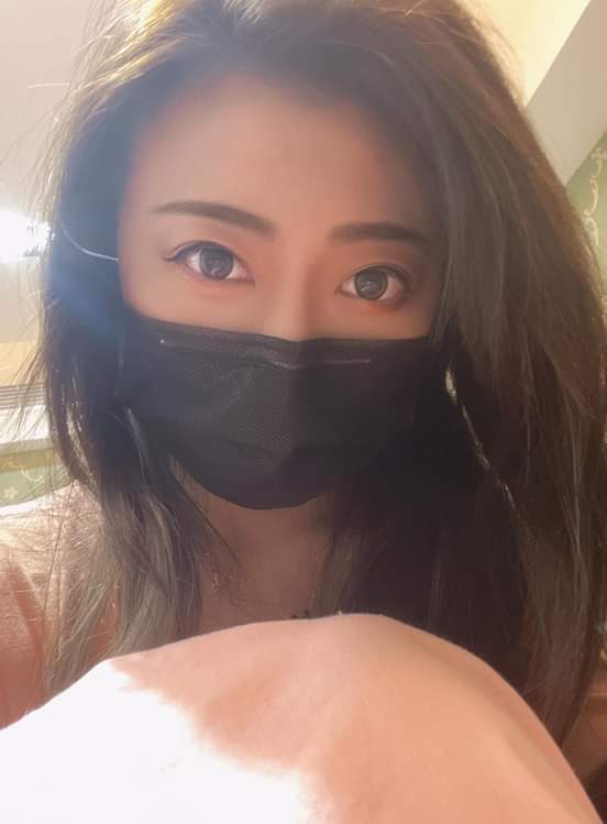 【雷射除毛】 趕快來一起除毛迎接夏天吧~跟毛毛說掰掰！！！-Ada 張佳佳