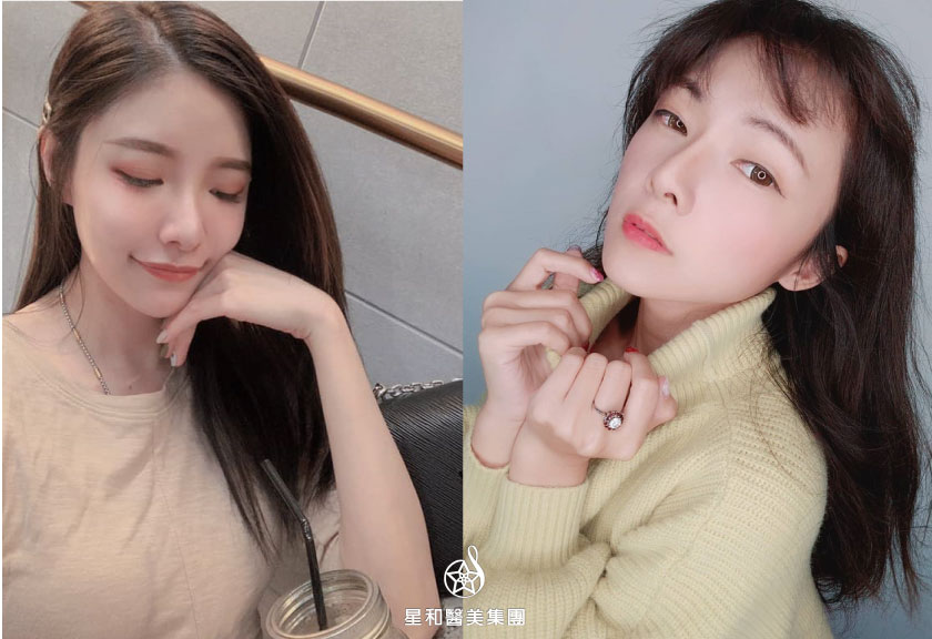 【杏仁酸煥膚】星和診所/台中醫美-讓自己變漂亮的小撇步- Abby Chen、藜兒