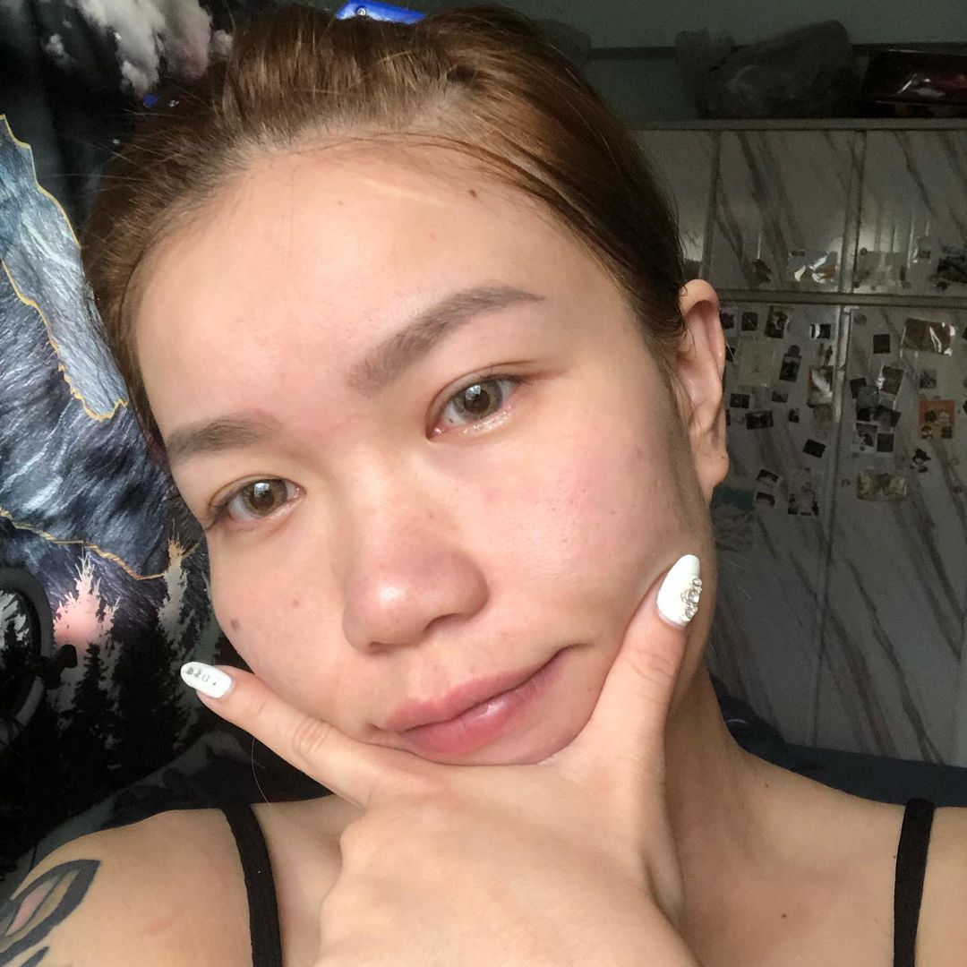 【皮秒雷射】星和診所/台中醫美-起床洗完臉零濾鏡94那摸漂亮❤️-Renata