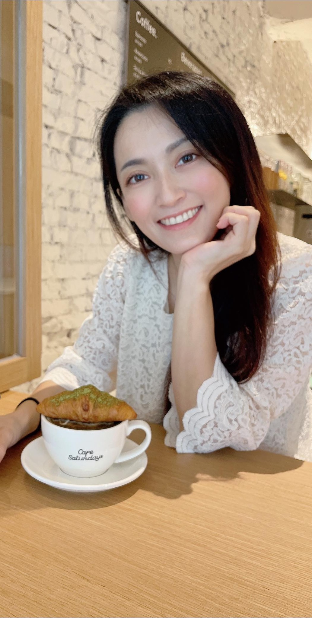 【皮秒雷射】星和診所/板橋醫美-趁孩子上學偷偷去變美，是地方媽媽的小確幸啊！-小飛媽媽咪呀